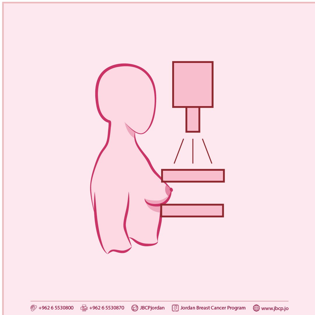 زارتني في العيادة عدّة مراجعات شُخِّصن حديثًا بـ #سرطان_الثدي – شفاهنَّ الله –، وكان حجم الورم لديهن صغيرًا (أقل من ١ سم)، وهو حجم يصعب اكتشافه أو الإحساس به يدويًا.

فكيف تم اكتشاف المشكلة بهذا الحجم الصغير وفي هذه المرحلة المبكرة؟

الجواب: عن طريق أشعة الكشف المبكر لسرطان الثدي