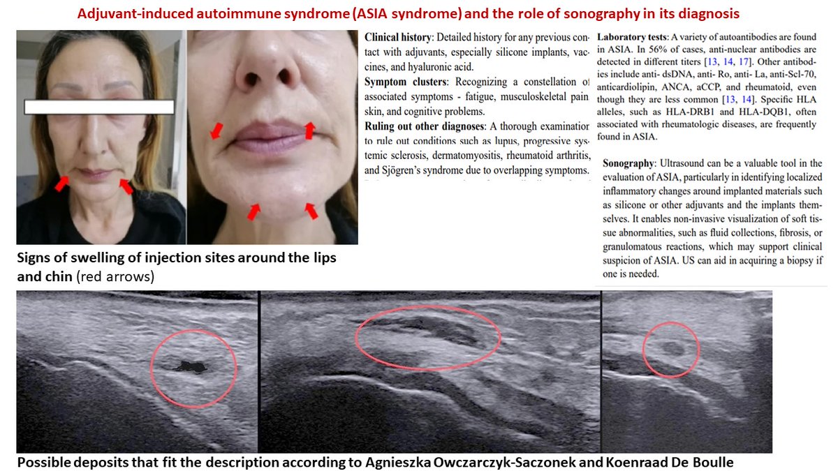 Rheumatology International tweet media
