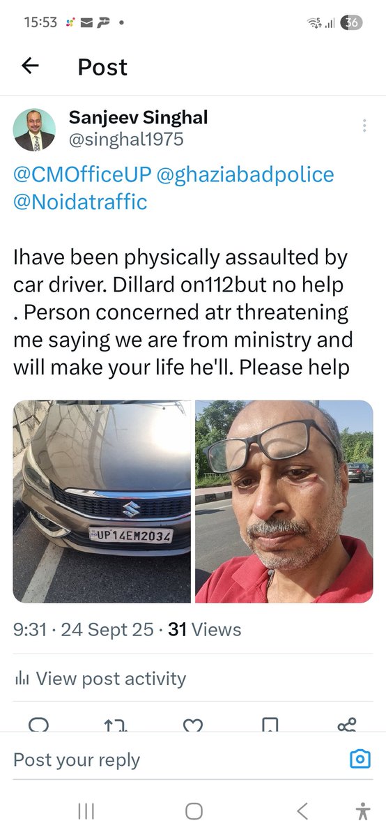 singhal1975's tweet photo. @PMOIndia @PIBHomeAffairs @noidapolice @CMOfficeUP @adgzonemeerut @AmitShahOffice @DoPTGoI @CP_Noida Ultimately ministerial position power prevail and instead of FIR, NCR is filed by concerned police officials in physical asault case where MLC is also done for reason better known to them. Does it mean ministry officials above law. https://t.co/XqiYNi1ERO