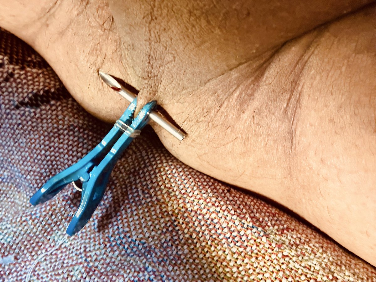SissyAnxi's tweet photo. 疼不疼的先放一边，这个4mm的针看着可太吓人了！拿手里跟拿了根笔似的。

而且镜子里的手好像不是自己的手一样，死活不听使唤，满头大汗折腾20分钟🙃🙃🙃 https://t.co/6a6soJi7vM