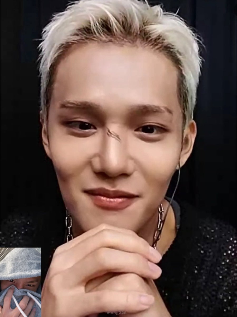mung226's tweet image. 251011 #CIX #승훈 #SEUNGHUN

오늘 완전 이뽀니🥔