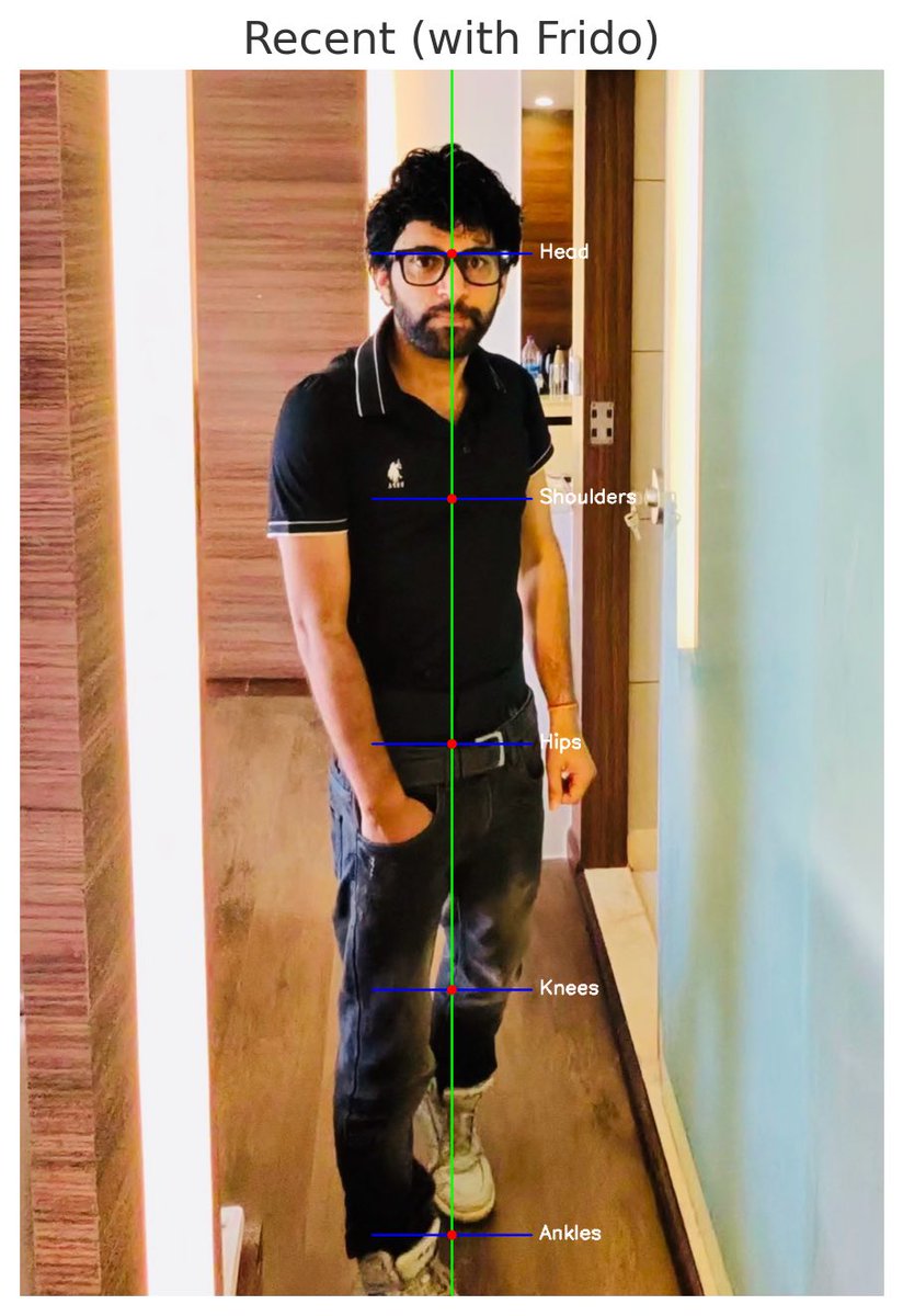 subhashchy's tweet image. My Frido Orthotics Posture Corrector Review.
i had posture issues since long, more so because of long seating sessions.
so placed a order, funny enough used a mumbai pincode with bangalore address. Ganesh and team was quick and they followed up till it was sorted.
here is…