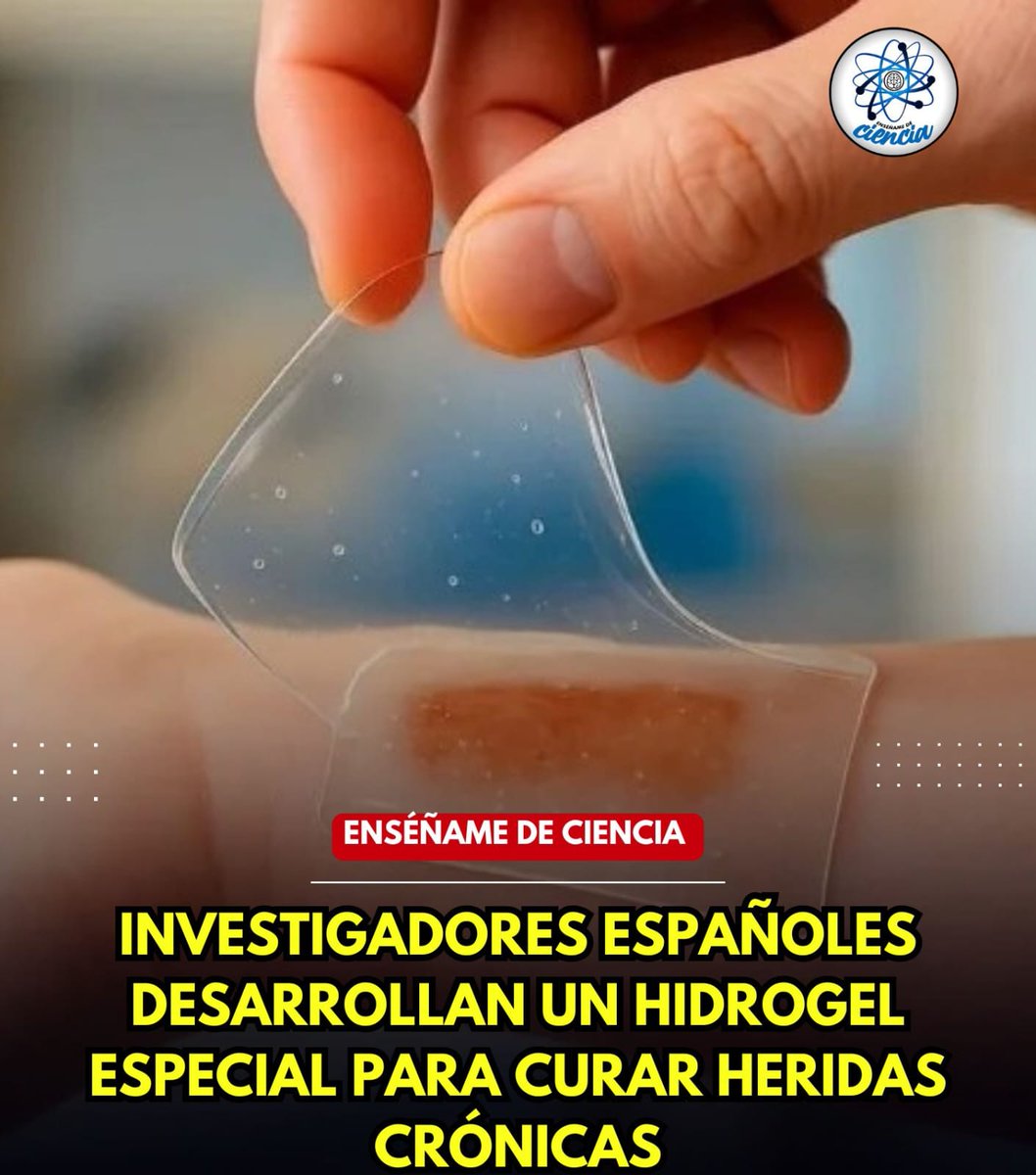 👩‍🔬Un equipo de científicos europeos ha puesto en marcha un proyecto que busca desarrollar un hidrogel autoadhesivo y autorreparable en 4D. 🤯

⚠️El propósito de este es el de administrar medicamento a la zona afectada y ayudar a reparar los tejidos dañados.👌🏼⚕️