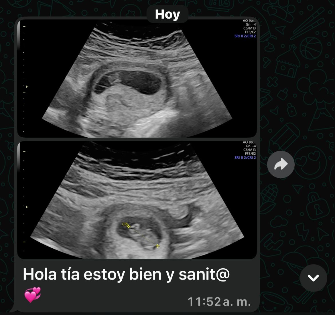 Ustedes entienden que voy a ser la tía más feliz del universo 🥹❤️