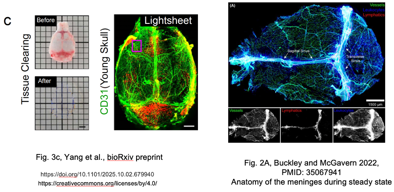 <a href="/KusumbeLab/">Anjali Kusumbe</a> These are vessels in the dura mater!