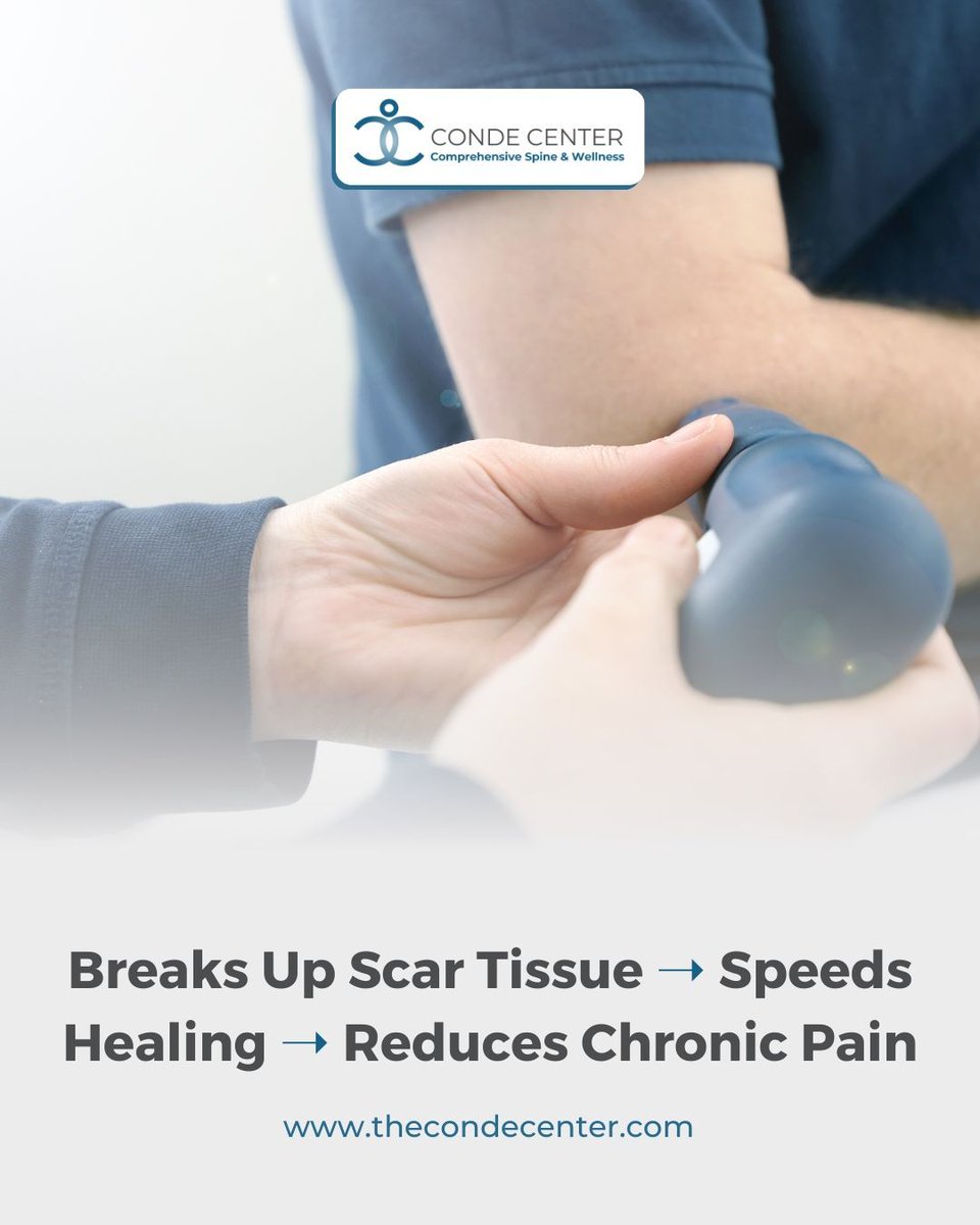 thecondecenter's tweet image. Say goodbye to chronic elbow, knee, or heel pain with Shock Wave Therapy at Conde Center. A breakthrough for tough-to-treat conditions.

📞 Book now for long-term relief.

#CondeCenter #ShockWaveTherapy #TennisElbowRelief #PlantarFasciitisHelp #AdvancedOrthopedicCare
