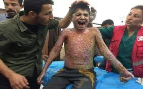 الطفل محمد من سري كانييه تم حرقة بقذائف الفسفور التي أطلقها الجيش التركي على المدنيين في تلك المنطقة الكوردية التي دخلها تحت غطاء المرتزقة السوريين ..
يومها كان اغلب المعارضة السورية تصفق للأتراك عندما قتلوا وهجروا الكورد منها ..