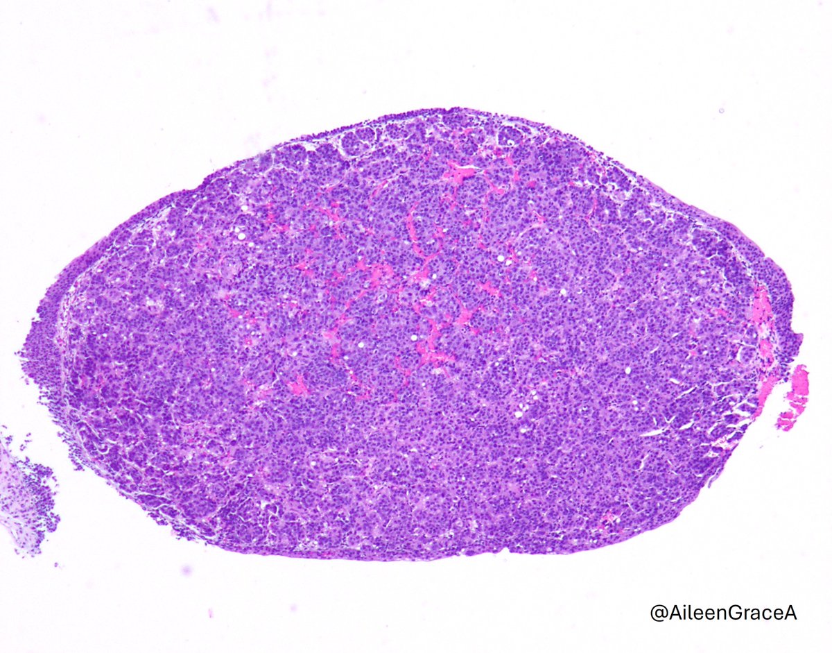 CooperPathology tweet media