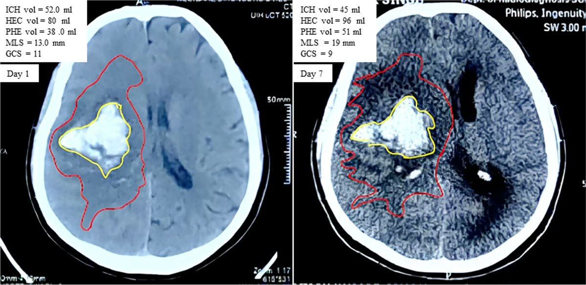 SCCM Neuroscience Section tweet media