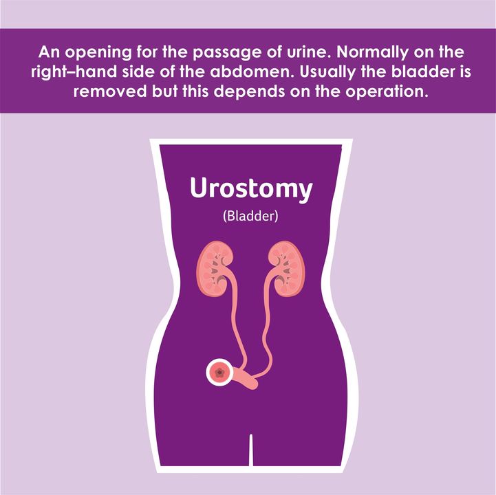 We’re on a mission to make stomas better understood, reduce stigma, and support those living with them.

Our #StomaAware campaign is packed with initiatives to drive change.
Find out more and get involved colostomyuk.org/campaigns/

#stoma #colostomy #urostomy #ileostomy #stomaaware
