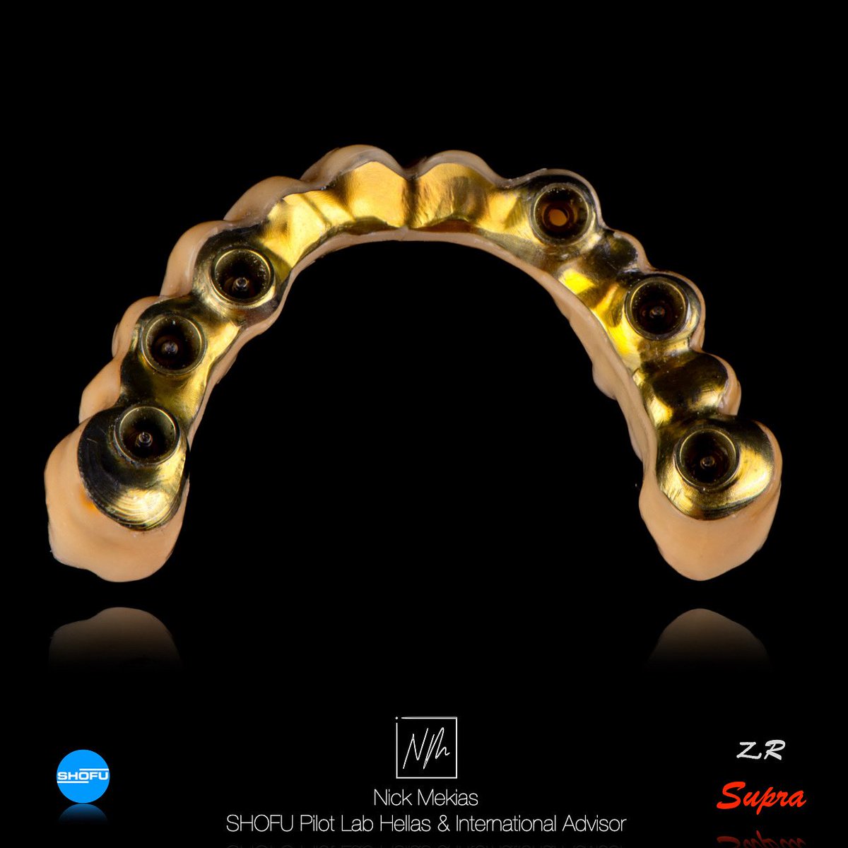 NikosMekias's tweet image. 🦷✨ Innovation. Precision. Artistry. ✨🦷
•Titanium bar: milled &amp;amp; anodised in-house
•Monolithic SHOFU supra zirconia: stained with SHOFU Universal Art Stains, A balance of technology and craftsmanship for impeccable results. 💎
#TitaniumBar #SHOFUStains #shofu #nikosmekias