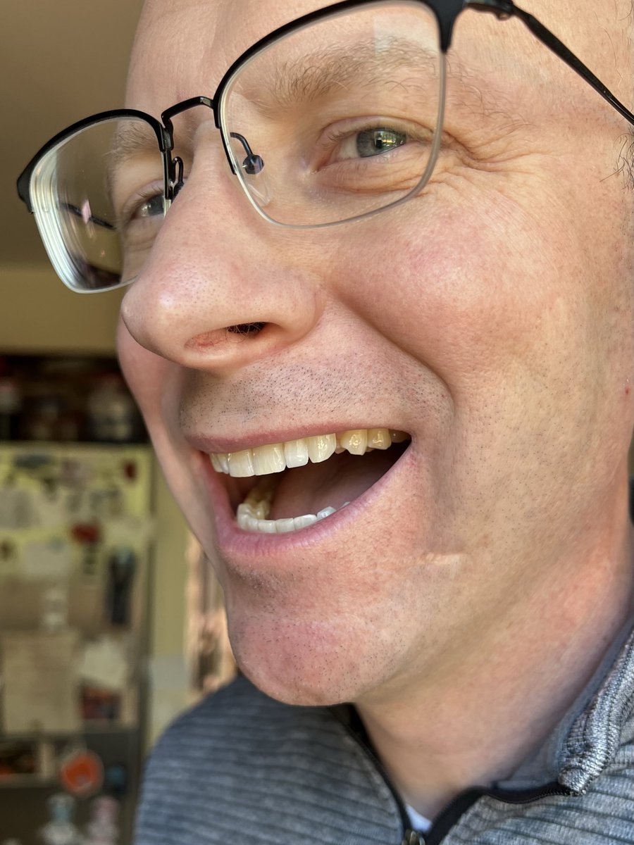 JonBbC_TechGeek's tweet image. For the first time in my life I decided to do a little cosmetic change to my teeth. I’m loving it so far. 🤩☺️