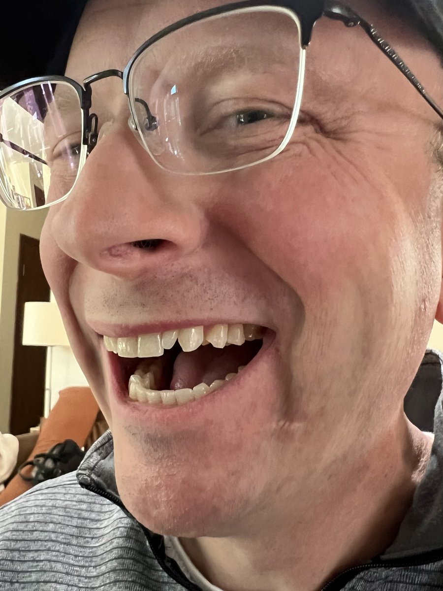 JonBbC_TechGeek's tweet image. For the first time in my life I decided to do a little cosmetic change to my teeth. I’m loving it so far. 🤩☺️