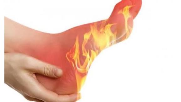 حرارة القدمين ..
يقول لك ايش: حرارة القدمين مع ألم .. اوووه تحاليلك سليمة، مالك علاج .. هذا لسان حال الطب الحديث
بالمقابل
والدتي حفظها الله هي أول شخص في السعودية تعالجت من حرارة القدمين وألم الكعب بواسطة عشبة الصفراء

قبل ٦ أيام مر علي صديق يشتكي من حرارة القدمين والساق مع ألم و