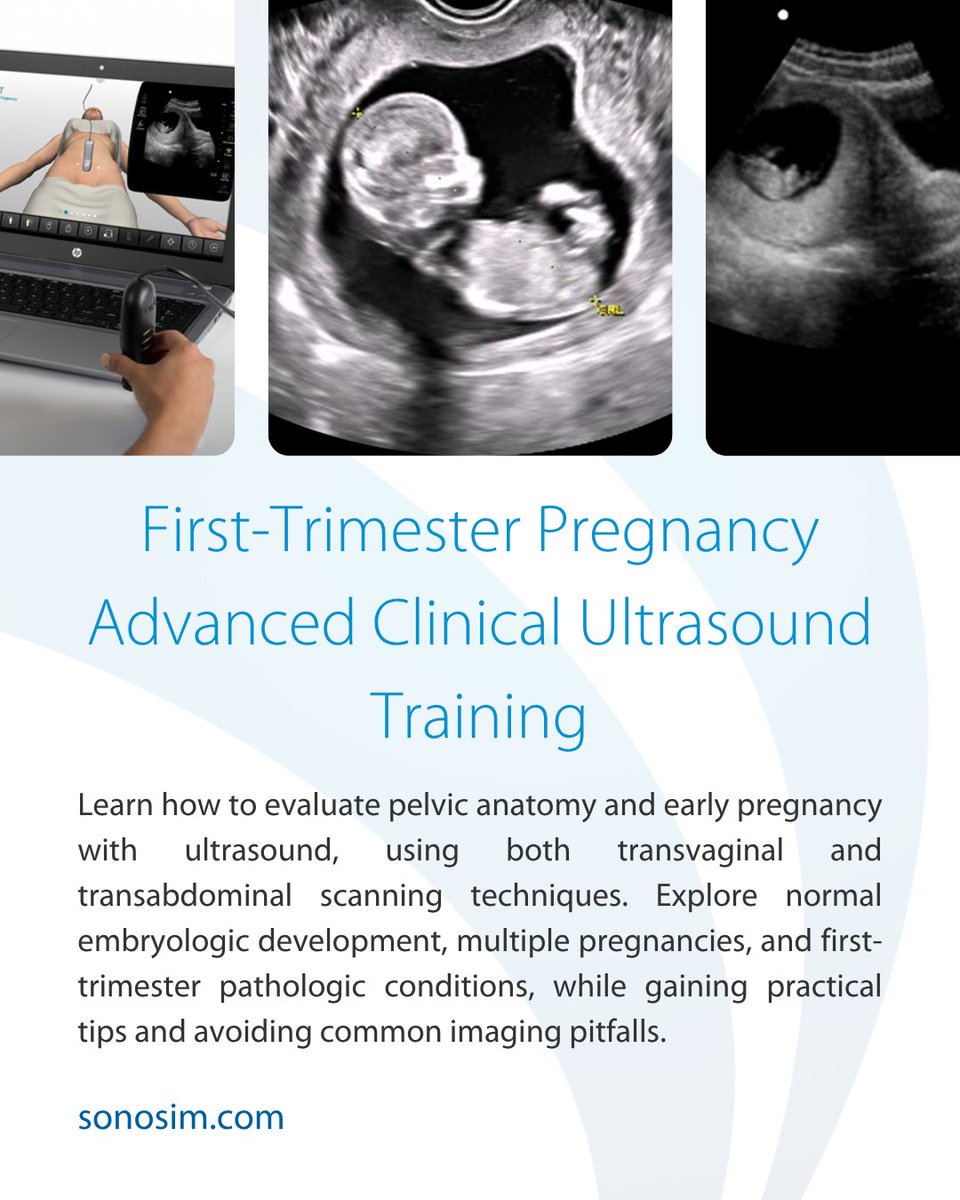 SonoSim, Inc tweet media