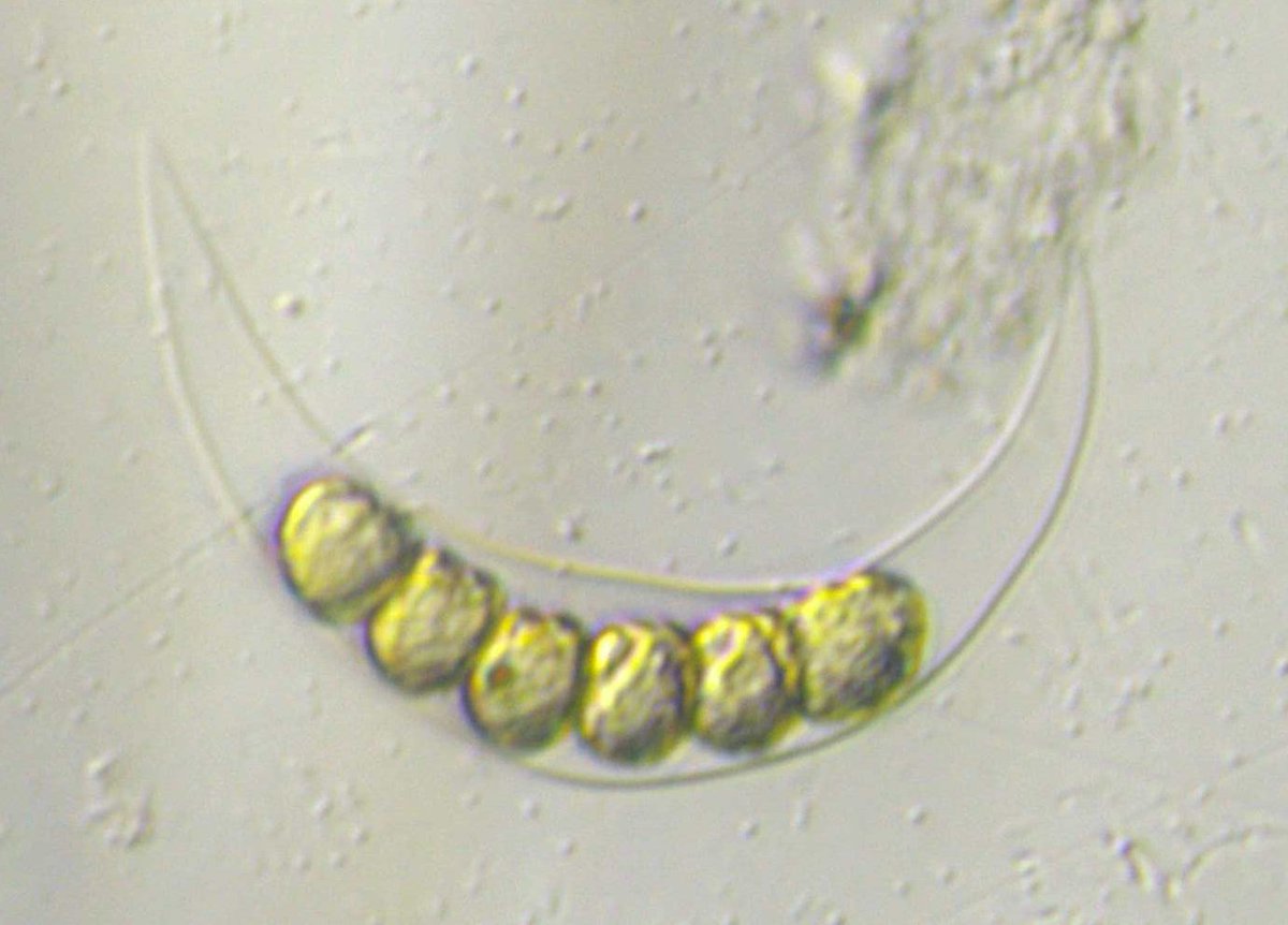 Plancton Andino con un equipo de 7 profesionales  presentará cinco investigaciones en #ICHA2025 en Punta Arenas #Chile. Temas #ADICFito #BloomPredictor #FAN #MONITORING #PSMB #FJORD #AQUA #HAB #POAS    <a href="/AquaExpoEC/">AQUAEXPO</a> <a href="/FAOfish/">Fisheries & Aquaculture</a> <a href="/InfoUMA/">Universidad de Málaga</a> <a href="/umagtv/">UMAG TV</a> <a href="/NaturaUdec/">Natura Udec</a> <a href="/CABD_UPO_CSIC/">Centro Andaluz de Biología del Desarrollo</a> <a href="/CEFAS_CEU/">CEFAS</a>