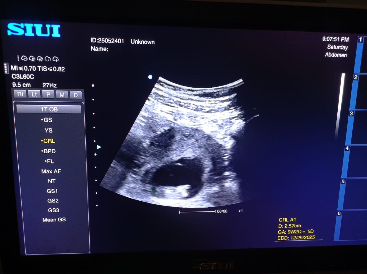 Let's break the algorithm with our hearts and hands

Please keep us in your prayers. I'm pregnant and have been diagnosed with malnutrition and anemia, and I fear for my unborn child. Every prayer, every share, and every donation counts

📎 gofund.me/4b903cc2