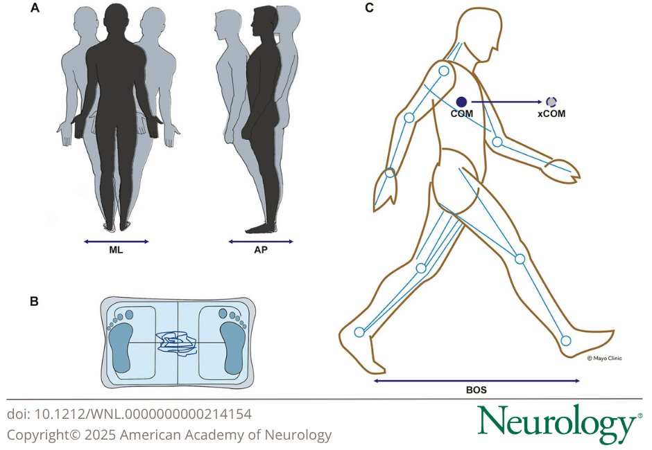 Gait Analysis in Neurologic Disorders: Methodology, Applications, and Clinical Considerations hubs.la/Q03MHsfL0

#NeuroTwitter #NeuroX