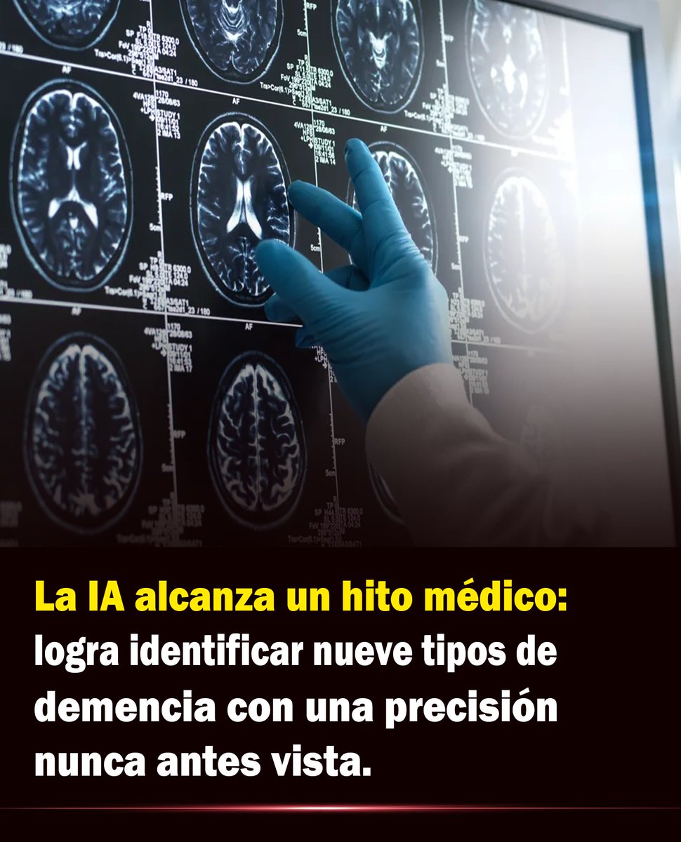 Bio_comunidad's tweet image. La inteligencia artificial acaba de romper una barrera médica: un algoritmo creado por la Clínica Mayo logró identificar nueve tipos distintos de demencia con una precisión del 93%, superando incluso a los expertos humanos. 👇

Mayor info: wp.me/p9eYmY-9aY