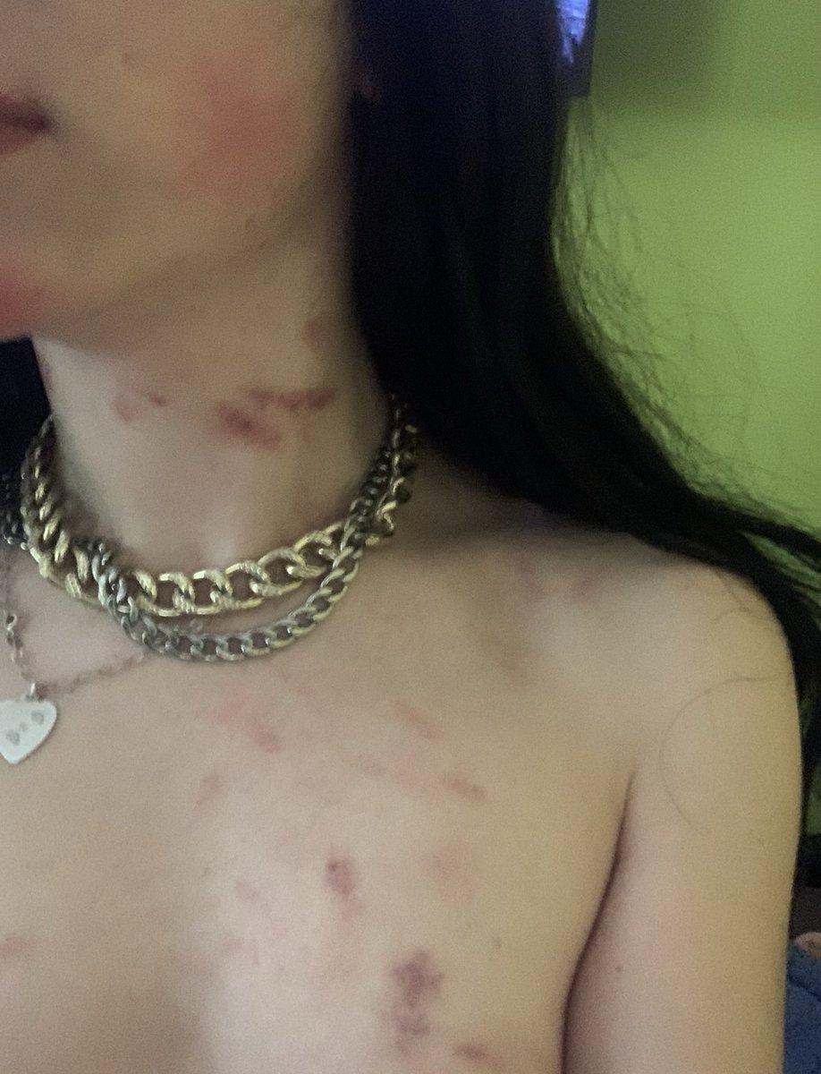 primer cliente satisfecho, quedan son 3 cupos aun. 

+56947148598, solo comprando contenido te llevas un heladito gratis, si quieres anal pagas extra 
miau

dale rt y mg si quieres dejarme mas chupetiá
