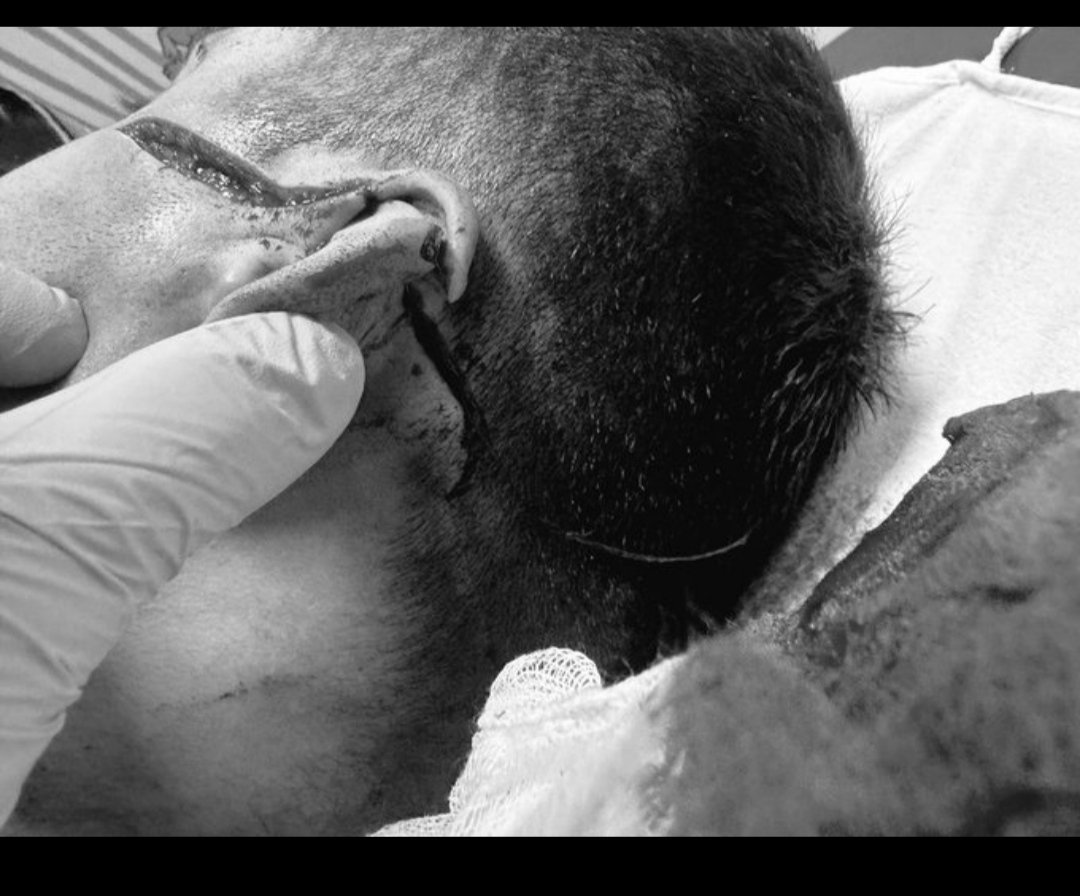 Karatepe Yüksek Güvenlikli Kapalı Ceza İnfaz Kurumunda infaz ve koruma memurlarının hükümlünün üst aramasını yaptığı esnada kantinde satılan meyve bıçağıyla saldırarak meslektaşlarımızın ağır yaralanmasına neden olmuştur.
ARTIK YETER
<a href="/yilmaztunc/">Yılmaz TUNÇ</a> 
<a href="/RTErdogan/">Recep Tayyip Erdoğan</a> 
<a href="/ctekurumsal/">Ceza ve Tevkifevleri Genel Müdürlüğü</a>