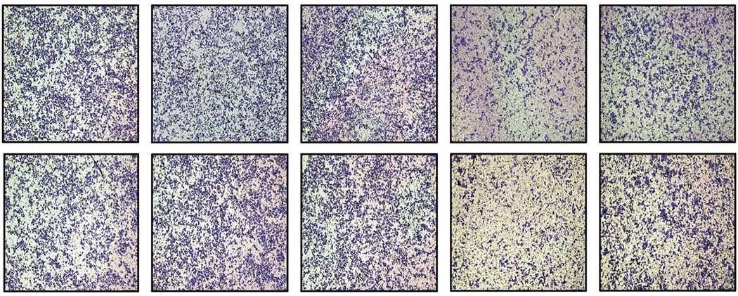 Intestinal_Cell's tweet image. In a recent @cddpress study, scientists confirmed that SNRPB is overexpressed in #GastricCancer and that this overexpression is associated with poor prognosis.
💡 Learn more: go.nature.com/3J5HLZB
