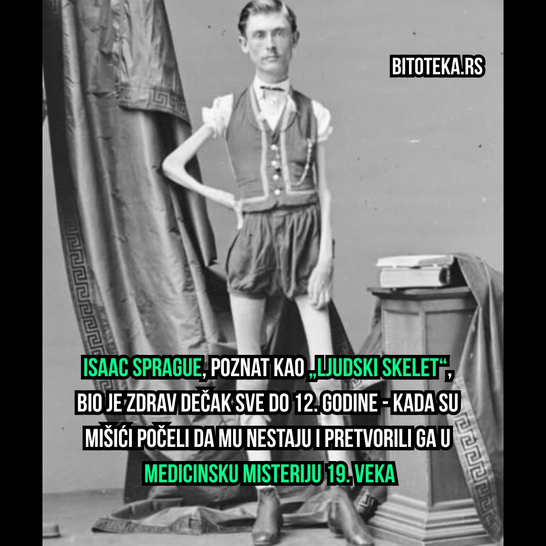 bitoteka's tweet photo. Uprkos bolesti koja mu je oduzela snagu, Isaac Sprague je postao zvezda Barnumovog cirkusa pod imenom „Ljudski skelet“. Umro je od gušenja, sa svega 19 kilograma, ali je ostao upamćen kao jedno od najzagonetnijih tela u istoriji medicine. 

#istorija #medicina #bitoteka #cirkus https://t.co/JPsYNaP8gi