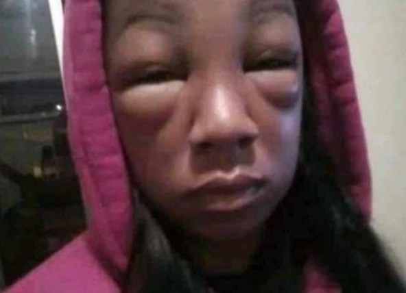 -estuviste llorando?
-como sabes?