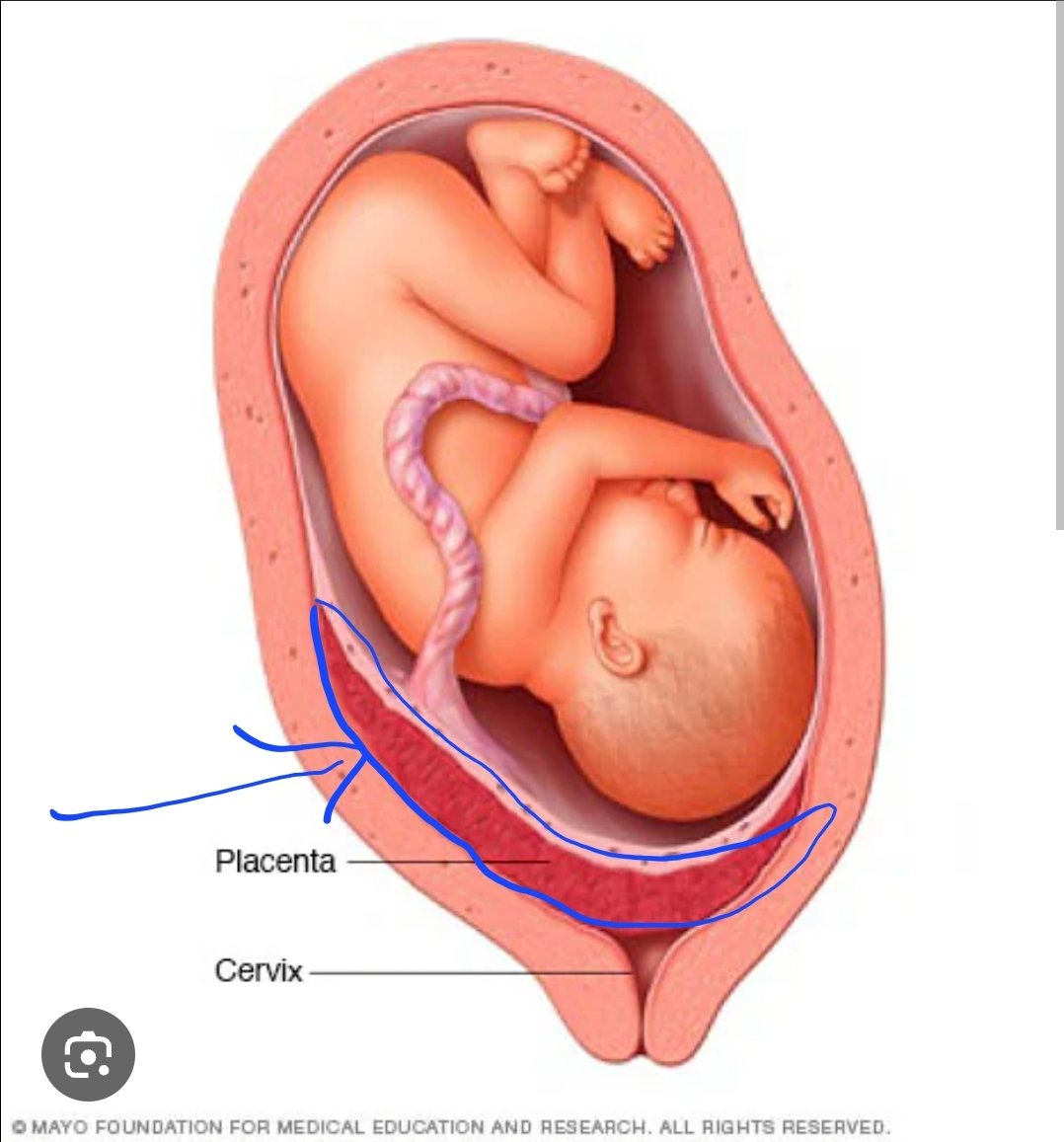 Fit those of you who didn't know. Here is where a baby is carried during pregnancy.  According to our beloved MAHA secretary of health