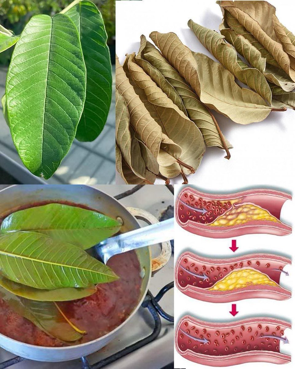 煮番石榴叶，尝一口治愈！ 🌿🍵你很享受番石榴的美味，但真正的秘密藏在叶子里！ 👀

🌿调节血糖和胆固醇
🌿舒缓消化，缓解腹胀
🌿清除粉刺，焕发光彩
🌿增强免疫力并对抗炎症

✅只需煮沸，浸泡一夜，空腹饮用即可。杯中自然疗法！ 💚