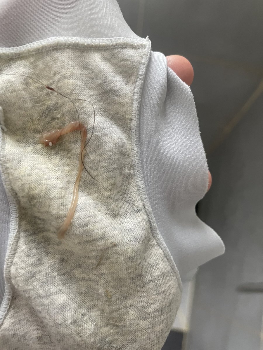 例假后掺点血丝的白带