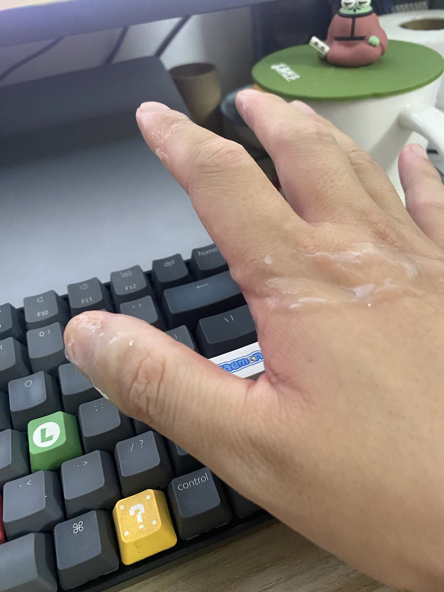 怎么流鼻涕了