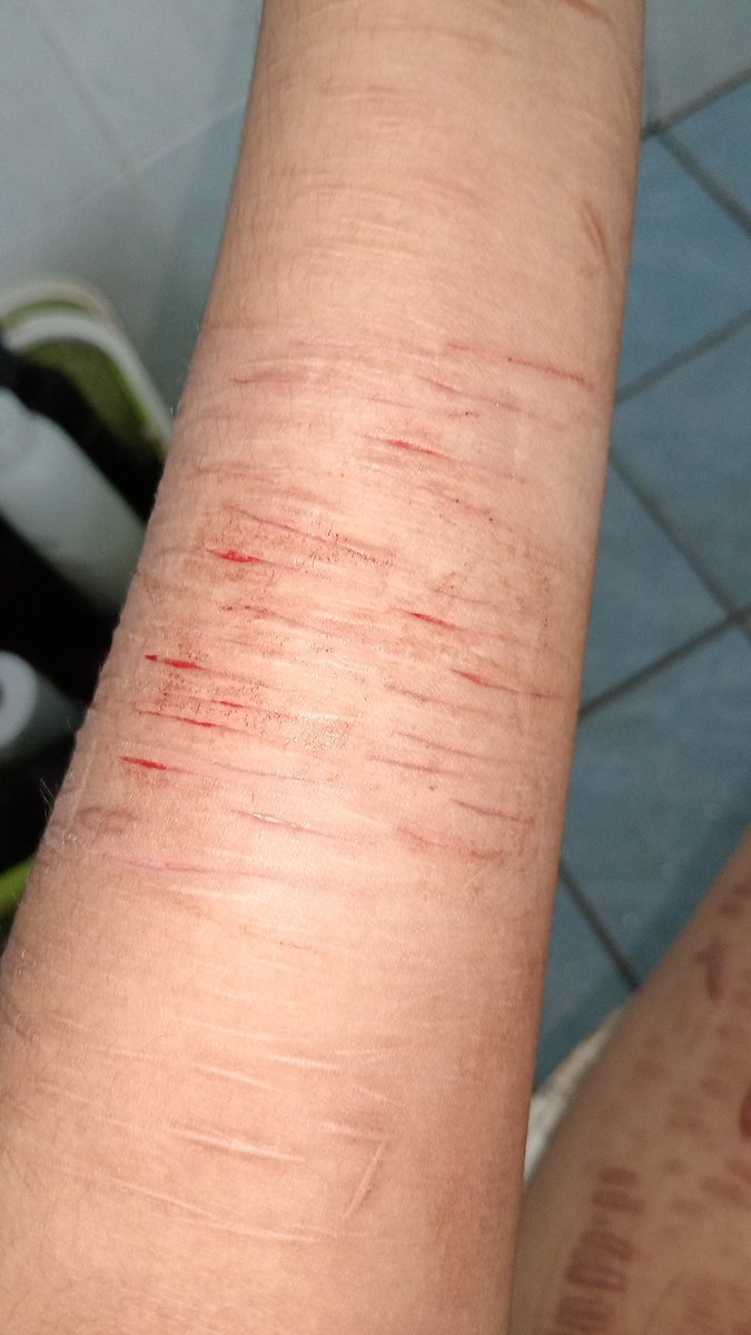 this is it now, 2 months almost 3 streak down the drain