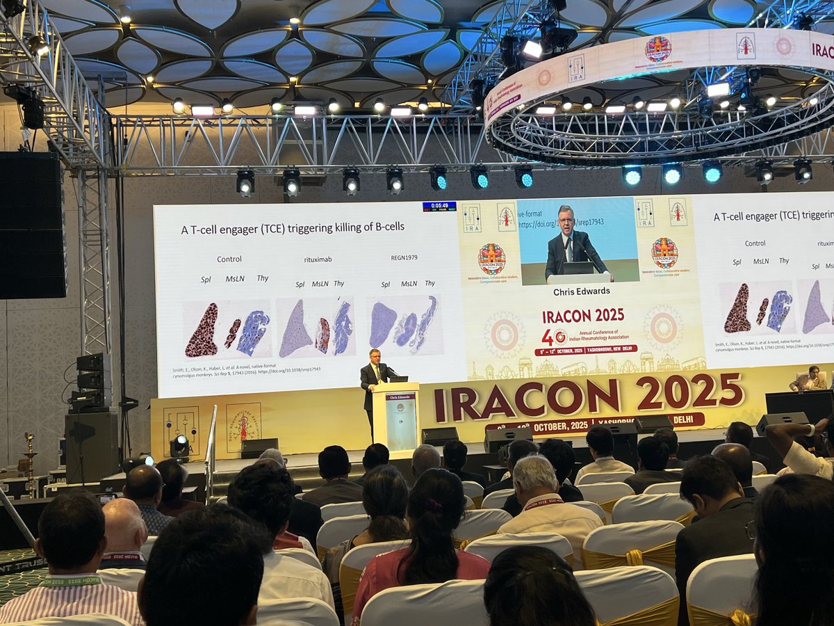 DurgaPrasannaM1's tweet image. Paul Bacon lecture by Prof @ChrisEdwardsRh at #IRACON2025 in New Delhi. A brilliant review of the clinical features, risk factors, Scott and Bacon criteria and management of this vanishing entity. He also presented the Indian experience presented at recent conferences. Key…
