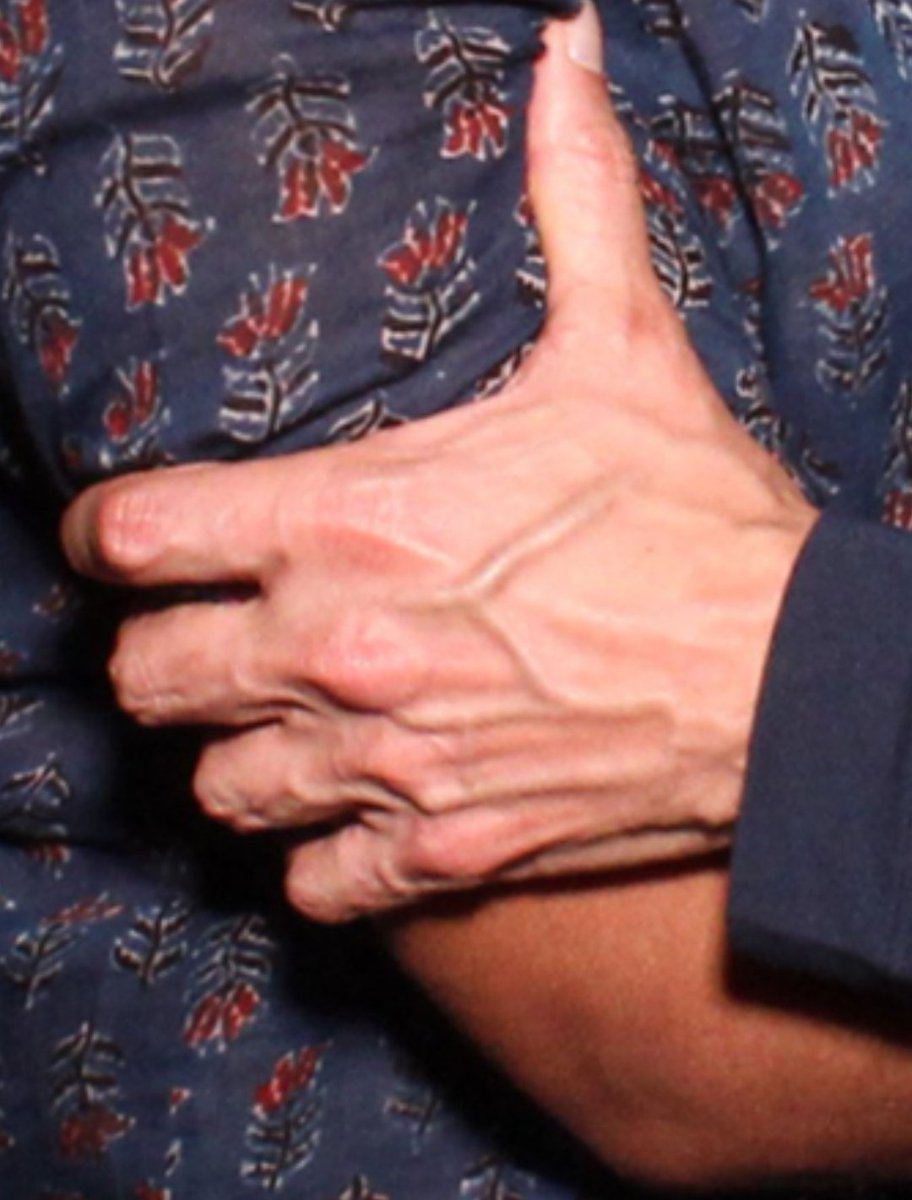 Hand and fingers 🤢🤢🤢 intha galiz ga unnay enti assalu