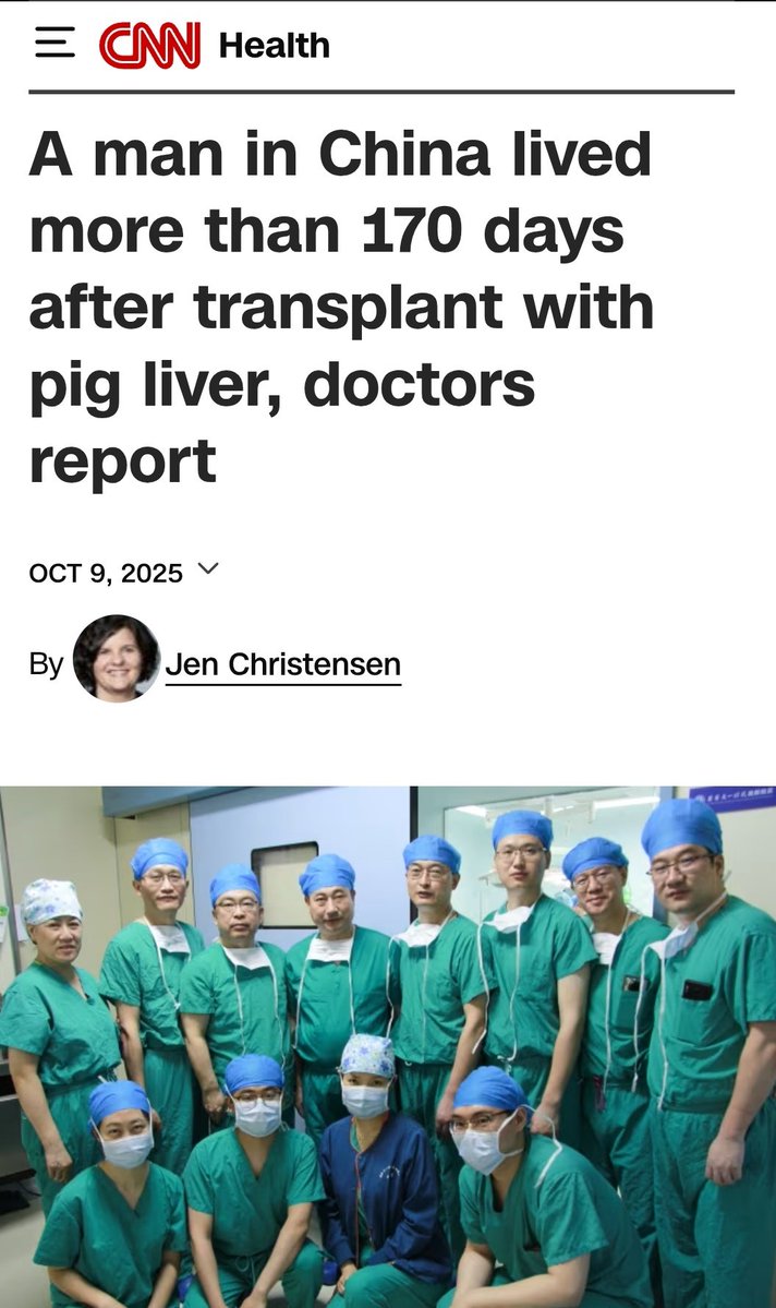 Indian__doctor's tweet image. World’s first pig liver transplant keeps man alive for 171 days in #China

But In 1997, INDIA&apos;s Dr. Dhani Ram Baruah** in #Assam** attempted a pig-to-human organ transplant!

👉👉 a bold step decades ahead of his time.
Instead of recognition, he was arrested, jailed, and branded…