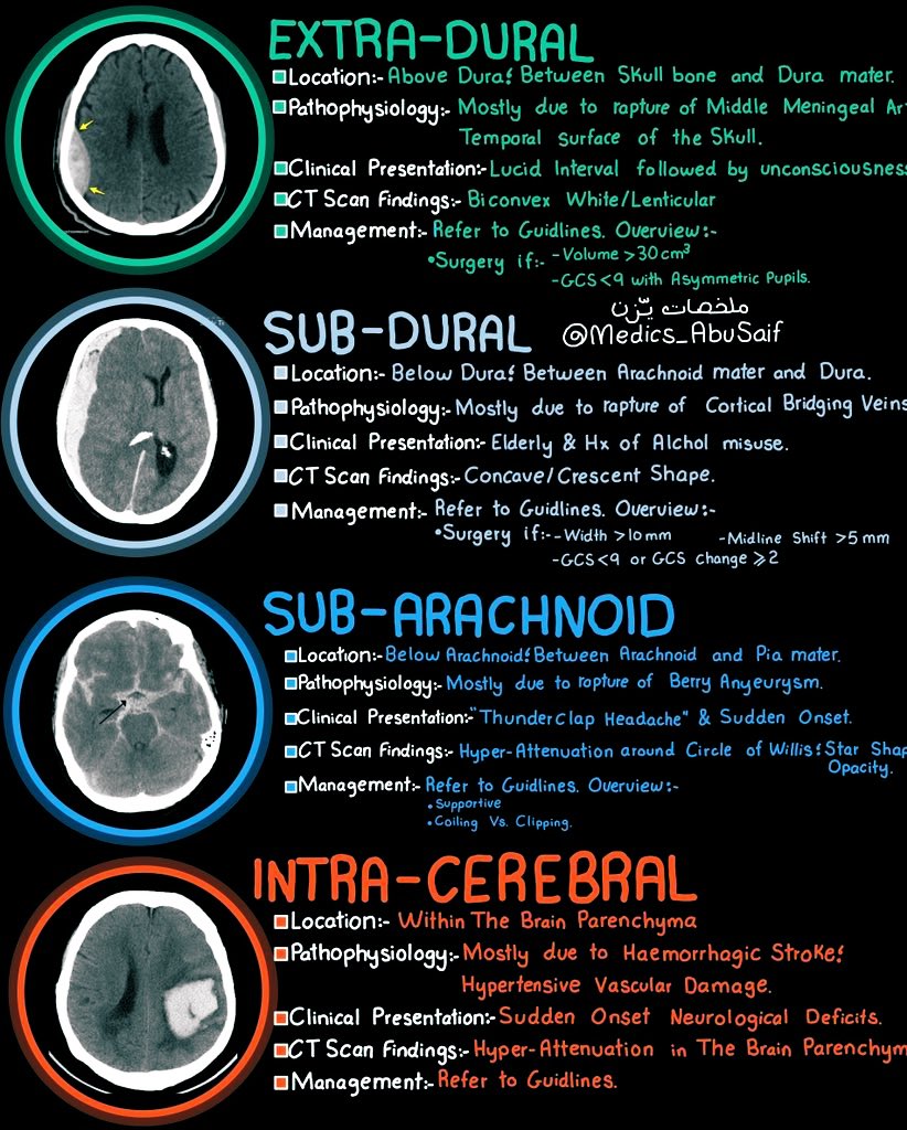 Cerebral Hemorrhage — Types &amp; Important Facts