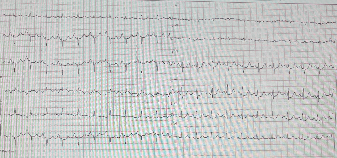 Magnus Nossen, MD tweet media