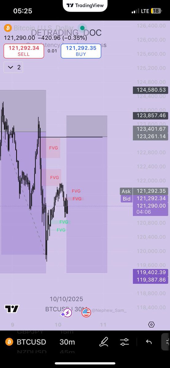 DeTrading_Doc01's tweet image. You all made profit yesterday right🥲🫠??!!.