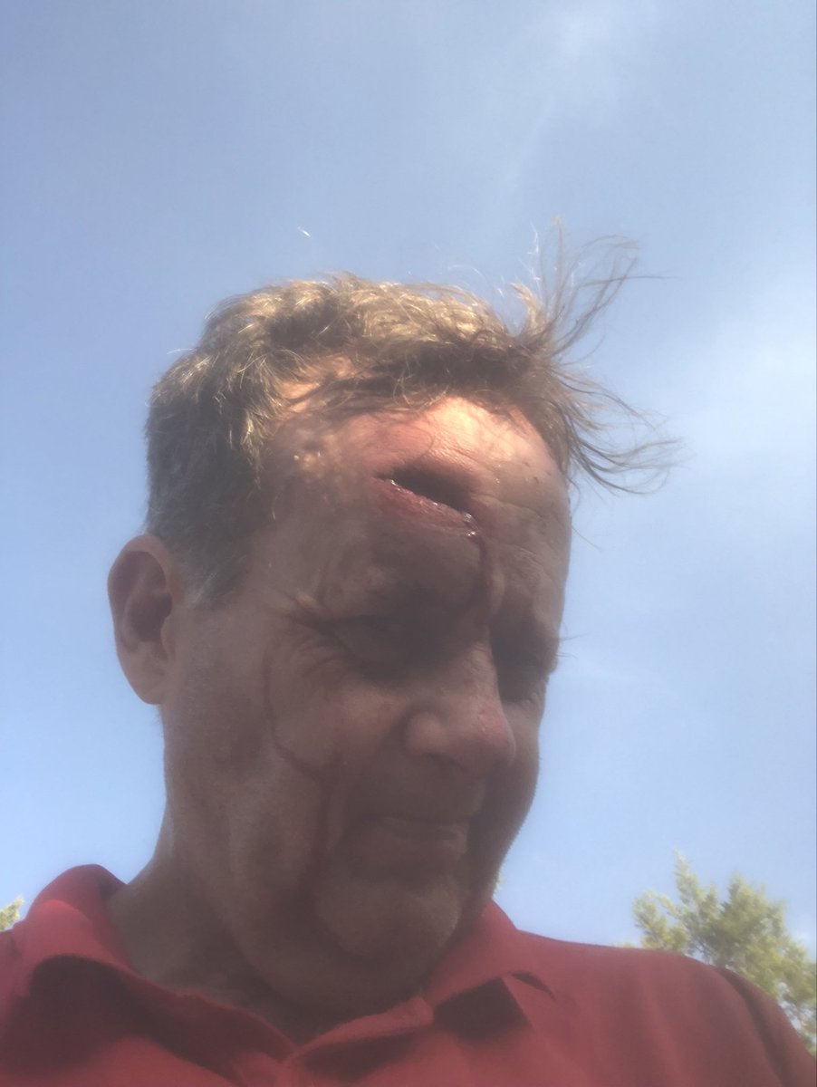 Why all the women in my life treat me so…..looks worse than it is