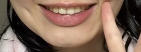 nonono_910's tweet photo. クソブス明かして申し訳ないんですけど、めちゃくちゃ表情筋鍛えたら笑った時の口の形が少しマシになったので、全然整形以外でも変わると思います、、、、、 https://t.co/DOYRnVkBJN