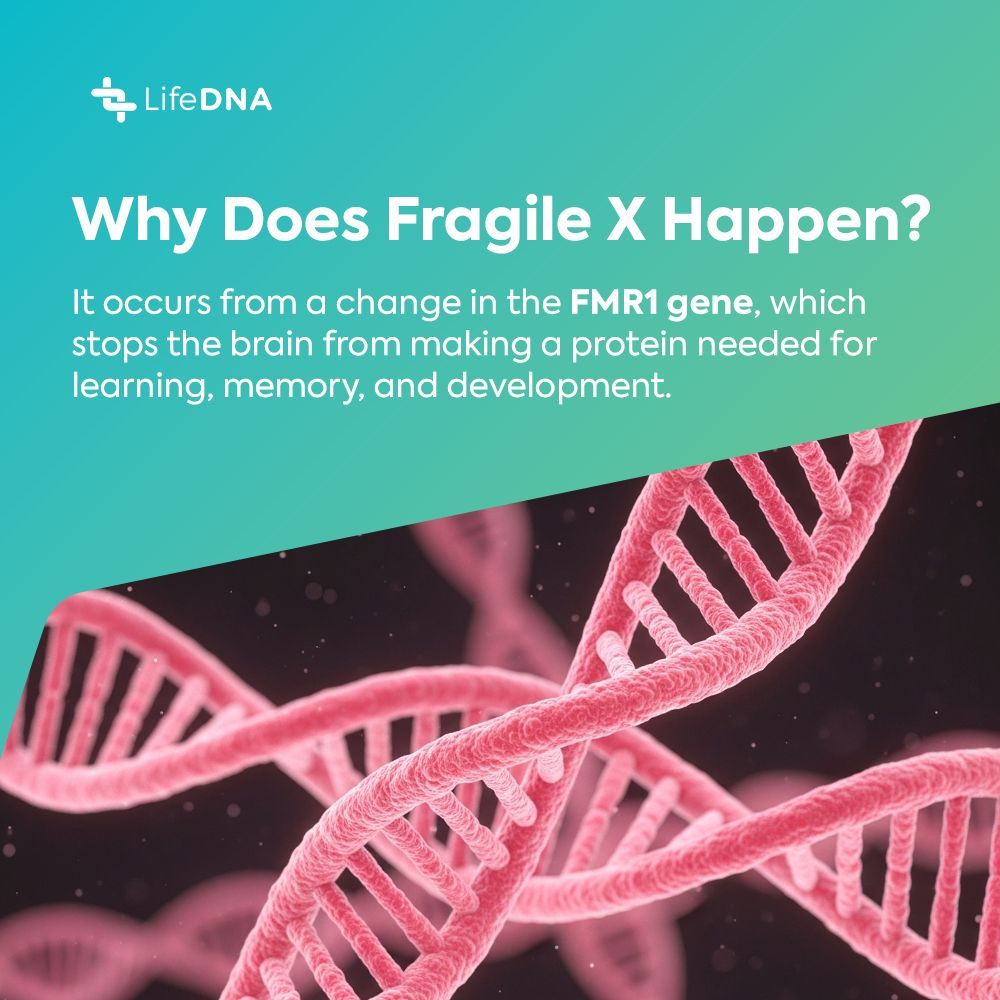 golifedna's tweet photo. Fragile X syndrome comes from a change in the FMR1 gene, where the CGG repeat expands over 200 times, turning the gene off and blocking a protein needed for brain communication, learning, and memory. Males are often more affected since they have only one X chromosome, while females may still make some of the missing protein.

As an X-linked inheritance pattern, it can run in families and affect each person differently. 

Read more: https://t.co/i5NUMx0YxZ

#wellness #genetics #DNA #healthylifestyle #healthandwellness #methylation