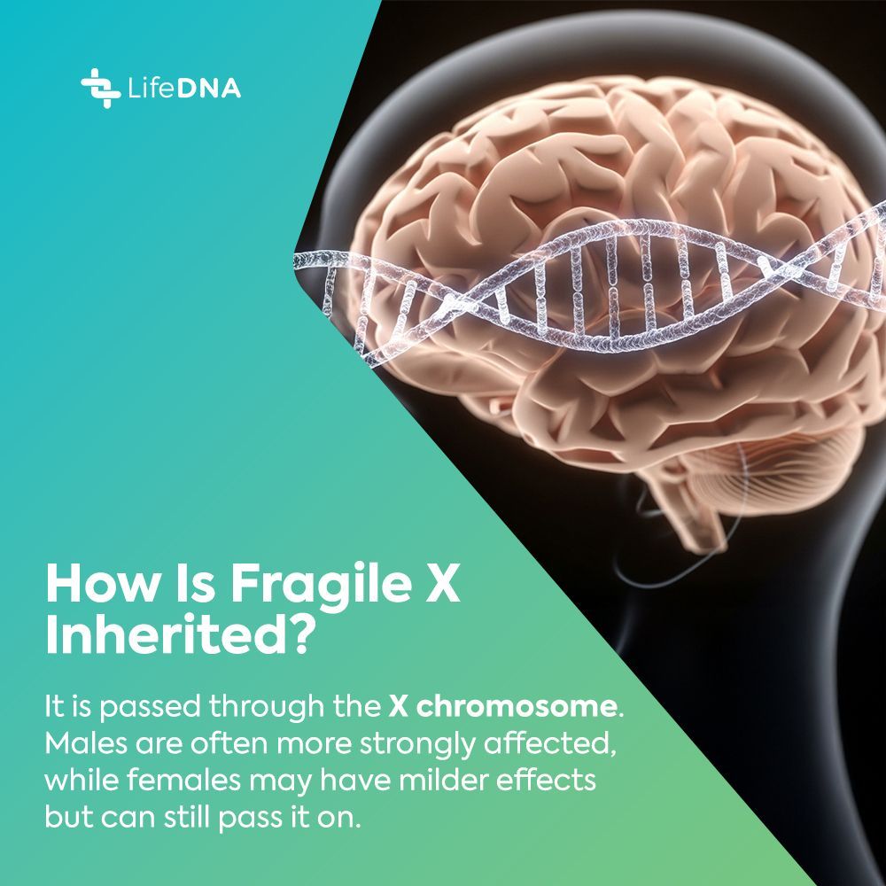 golifedna's tweet photo. Fragile X syndrome comes from a change in the FMR1 gene, where the CGG repeat expands over 200 times, turning the gene off and blocking a protein needed for brain communication, learning, and memory. Males are often more affected since they have only one X chromosome, while females may still make some of the missing protein.

As an X-linked inheritance pattern, it can run in families and affect each person differently. 

Read more: https://t.co/i5NUMx0YxZ

#wellness #genetics #DNA #healthylifestyle #healthandwellness #methylation
