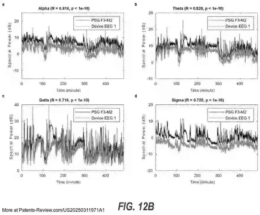 PatentPulse's tweet image. New patent application #US20250311971A1 from #GeorgiaTechResearch unveils a soft wireless wearable sensor system for sleep quality detection and disorder diagnosis. 
  
This system offers portable, at-home monitoring with embedded #MachineLearning, providing an alternative to…