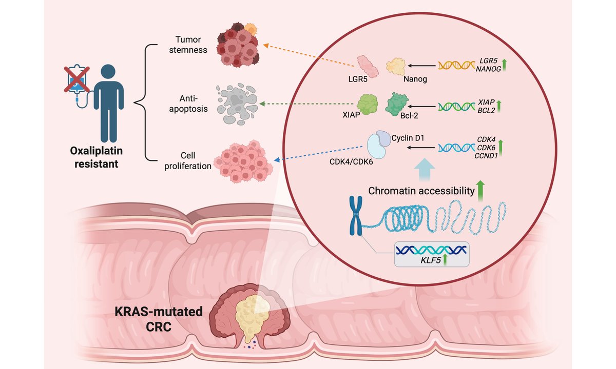 cdrjournal's tweet image. 🙌New publish in #Cancer #DrugResistance on 10 Oct.

👉Title: KLF5 promotes tumor proliferation and #oxaliplatin resistance via chromatin remodeling in KRAS-mutated #ColorectalCancer.

👀Read more: oaepublish.com/articles/cdr.2…