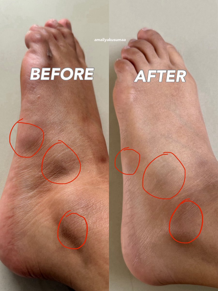 I WISH... I KNEW... EARLIER...

no more lipatan item, worth every penny👍🏻