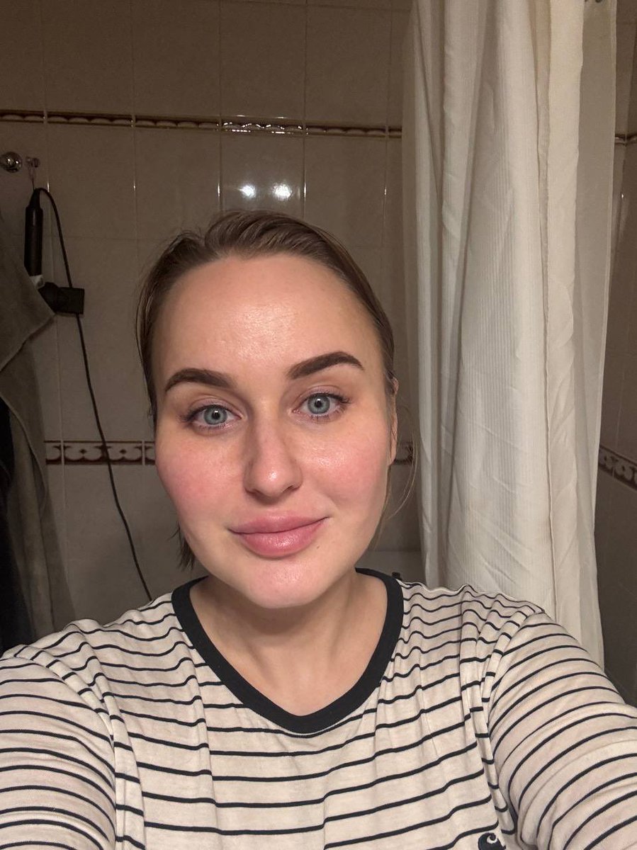 Вчера увидела свое лицо, когда устраивалась на работу прошлым летом… пиздец!!!! Не зря у меня почти нет фоток с периода, когда я набрала вес

Кстати сейчас я все еще вешу на 7 кг больше чем обычно, но уже не выгляжу как пельмень