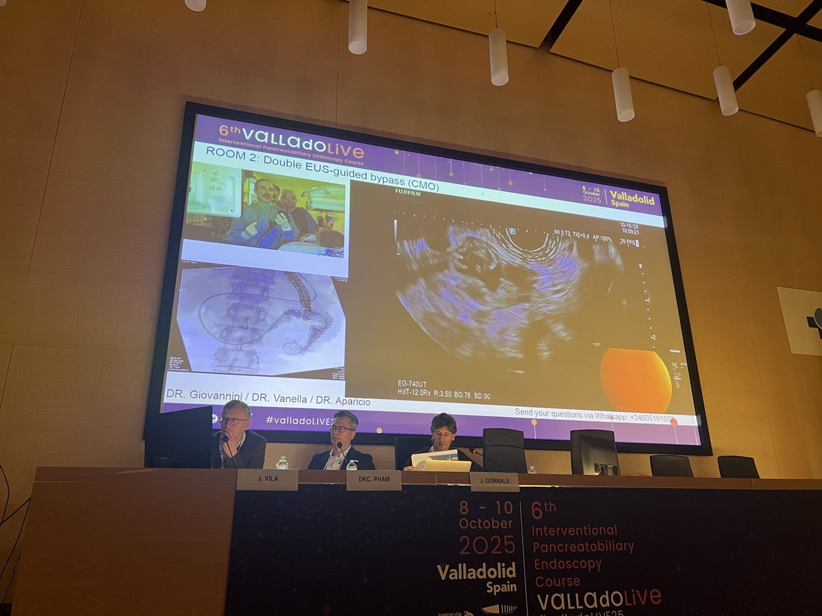 G Vanella &amp; <a href="/japariciot2/">José Ramón Aparicio</a> beautiful demonstration of yet another case of single session double bypass 

#ValladoLive2025 <a href="/EndoscopyOA/">Endoscopy On Air</a>