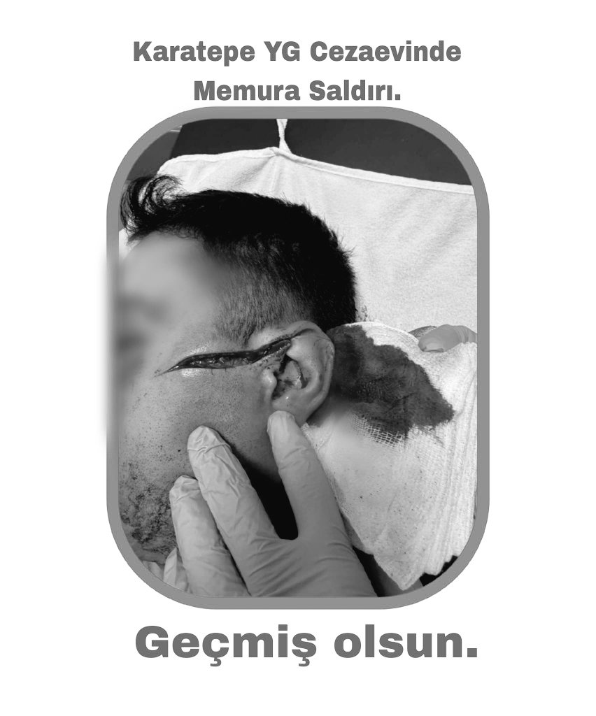 İnfaz Koruma Memurları, güvenlik temelli görevlerini yerine getirirken saldırıya uğruyor. Bu saldırıların izlerini gittikleri her yere taşıyor ve her aynaya baktıklarında o izleri hatırlıyor, topluma çıkma fobisi yaşıyorlar.

Görevi başında saldırıya uğrayan kardeşlerimize geçmiş