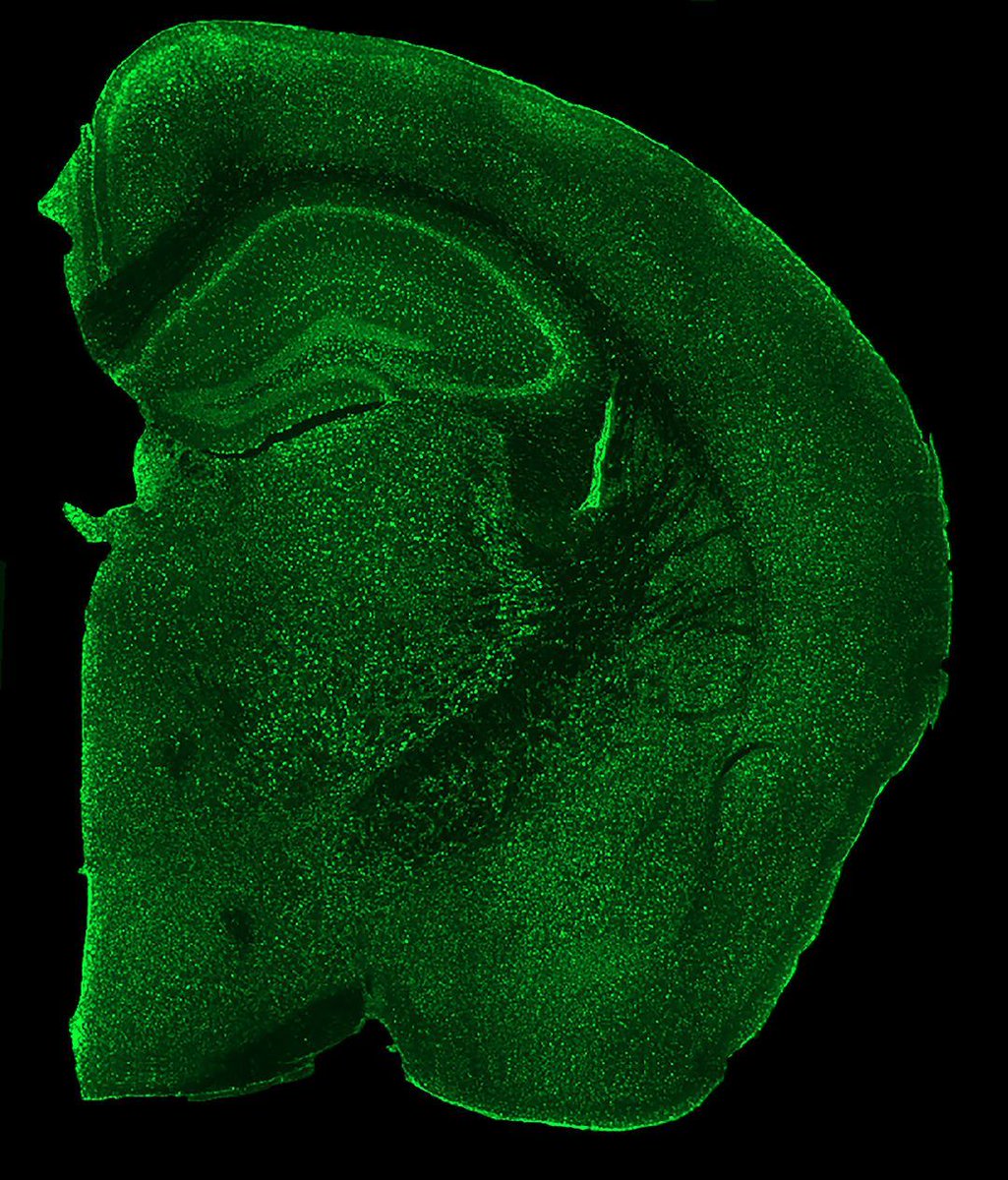 JCI_insight's tweet photo. CLN2 disease is a childhood-onset neurodegenerative lysosomal storage disorder caused by a deficiency of TPP1, but little is known about the cellular etiology.

@Batten_PSDL @keigotakahashi6 @noahs_hope1 @washumedicine now reveal GABAergic interneurons contribute to the fatal seizure phenotype in CLN2 disease mice: https://t.co/hWMGQtbKkK 

The image shows widespread SCMAS accumulation (green) in Cln2R207X/R207X mice at 15 weeks.